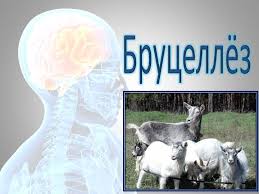 Бруцеллёз